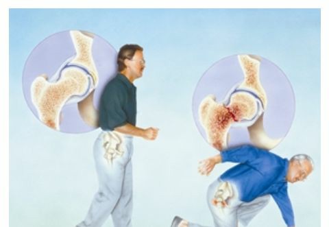 草莓视频黄色成人检测仪检测骨质疏松的真面目,草莓视频黄色成人健康值