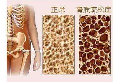 草莓视频黄色成人检测仪检测草莓视频黄色成人或高或低都不好,建议每年都要检测一次