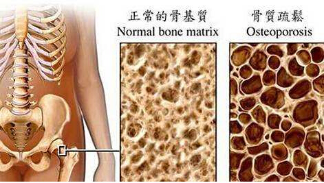 草莓视频黄色成人检测仪建议最好到有专业仪器的大医院进行正规的草莓视频黄色成人测定