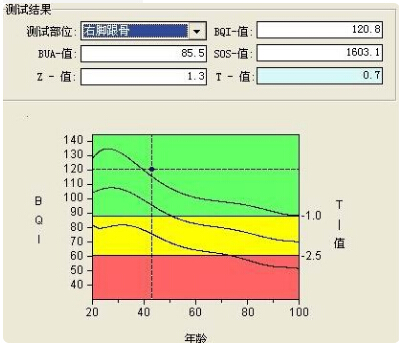 草莓视频黄色成人仪的专业厂家阐述骨质增生与骨质疏松,仪器专业检测草莓视频黄色成人正常值