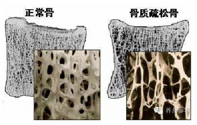 国产草莓视频黄色成人品牌你的骨头真的不能再等了 如何测量草莓视频黄色成人?
