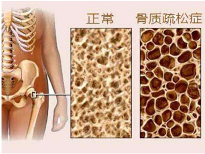 草莓视频黄色成人检测有什么作用 在什么部位做草莓视频黄色成人检查比较好