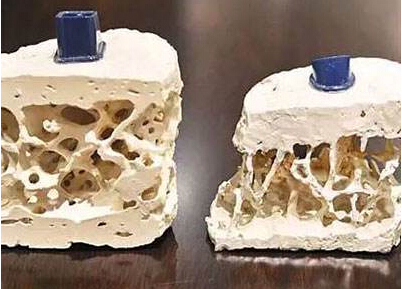 草莓视频黄色成人检测仪知名厂家阐述中老年人应该是草莓视频黄色成人检测重点对象