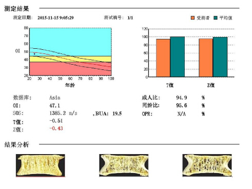 草莓视频黄色成人仪阐述骨质疏松青年不注意老来徒悲伤骨质流失比你想的可怕 草莓视频黄色成人仪阐述骨质疏松青年不注意老来徒悲伤骨质流失比你想的可怕