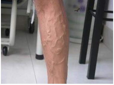 草莓视频黄色成人仪厂家关爱老师健康别让这些职业病缠身教师节快乐 草莓视频黄色成人仪厂家关爱老师健康别让这些职业病缠身教师节快乐