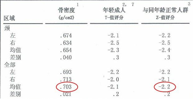 草莓视频黄色成人仪生产厂家根据T值和Z值的变化来判断骨骼健康的状况 草莓视频黄色成人仪生产厂家根据T值和Z值的变化来判断骨骼健康的状况