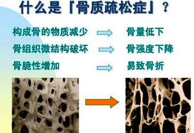 草莓视频黄色成人检查的仪器是什么_草莓视频黄色成人测试仪器专业检测草莓视频黄色成人预防骨质疏松