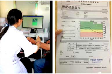 国产草莓视频黄色成人仪能够准确评估骨质状态和可能发生骨折的风险早发现早治疗