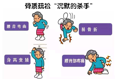 全身草莓视频黄色成人仪介绍骨质疏松远比你想象厉害这些人要特别注意
