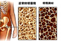 草莓视频黄色成人仪品牌介绍市场上最常用的草莓视频黄色成人设备看看哪种适合自己医院采购