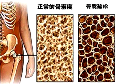 草莓视频黄色成人仪品牌介绍市场上最常用的草莓视频黄色成人设备看看哪种适合自己医院采购