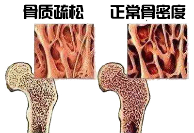 草莓视频黄色成人仪生产厂家介绍其实各个年龄阶段草莓视频黄色成人不同最佳检测年是多少你知道吗？