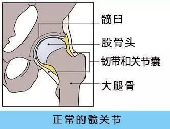 草莓视频黄色成人检查仪人身体出现哪些情况需要做髋关节置换术