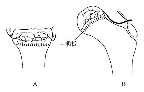 草莓视频黄色成人测试仪生产厂家骨骺生长停止后还能修复吗？