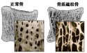 草莓视频黄色成人分析仪的价格是多少，要小心提防骨质疏松影响工作和生活