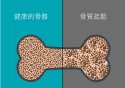 老年人骨质疏松易导致骨折之超声草莓视频黄色成人检查仪的临床价值是什么？