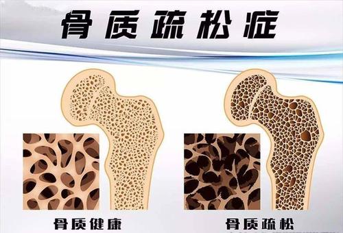 国产草莓视频黄色成人仪器有效预防骨质疏松症依赖于定期的草莓视频黄色成人测试 国产草莓视频黄色成人仪器有效预防骨质疏松症依赖于定期的草莓视频黄色成人测试
